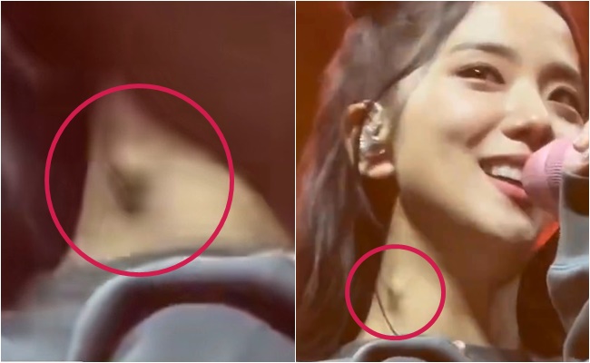 Fans are worried about BLACKPINK Jisoo's health after seeing the tumor on her neck